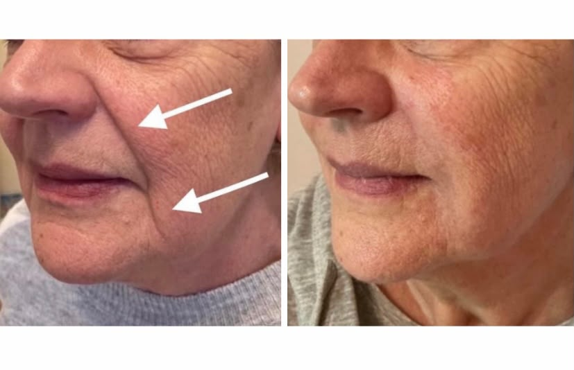 Client before and after treatment, comparison 3
