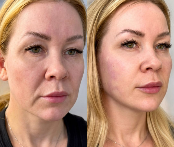 Client before and after treatment, comparison 6