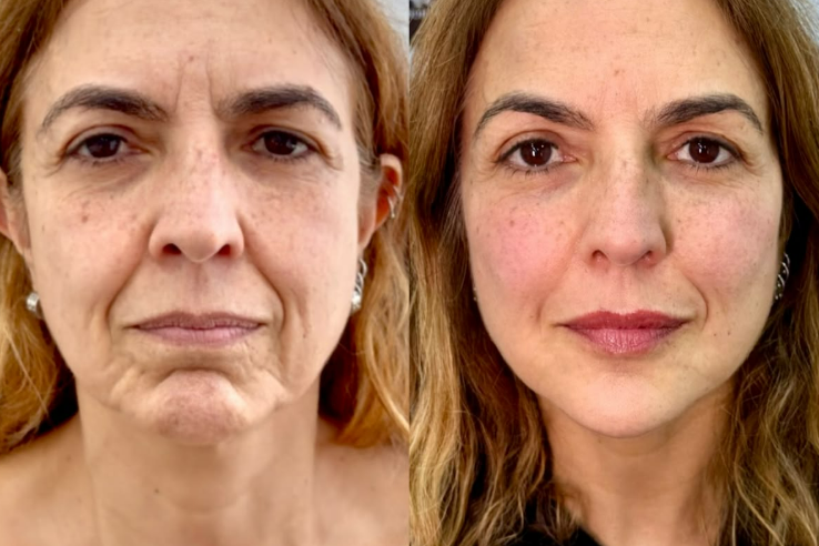 Client before and after treatment, comparison 7