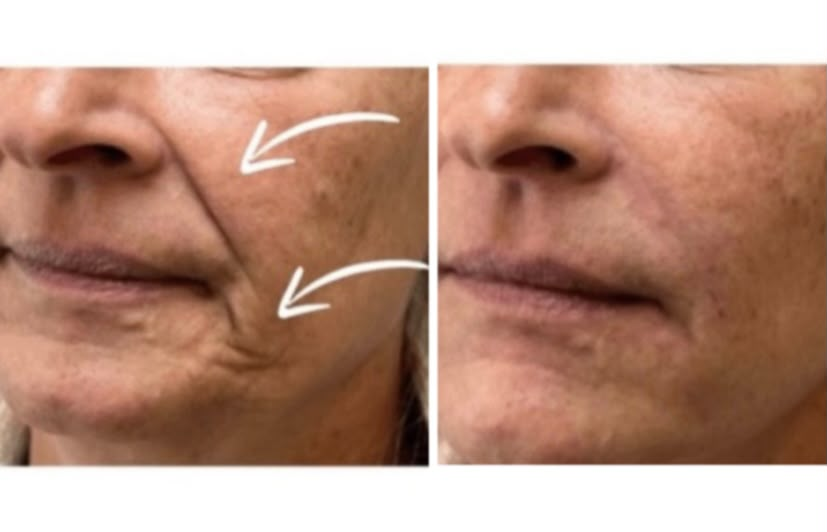 Client before and after treatment, comparison 2