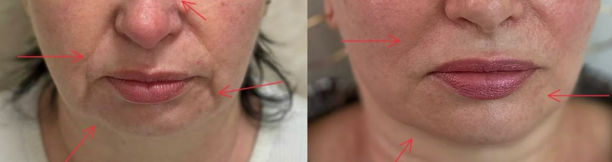 Client before and after treatment, comparison 8